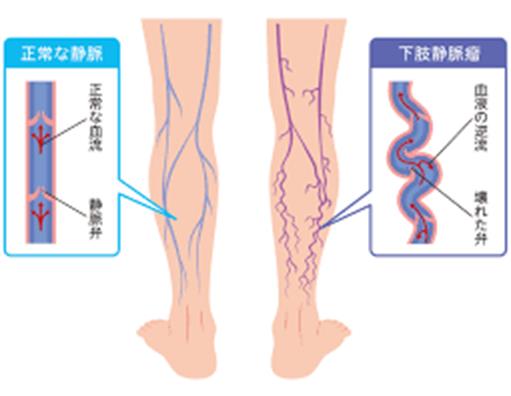 Ö - ݂悵n[gNjbN - ݂悵s̓ȁEzȁEO