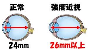 156.xߎ肢炱߂āI