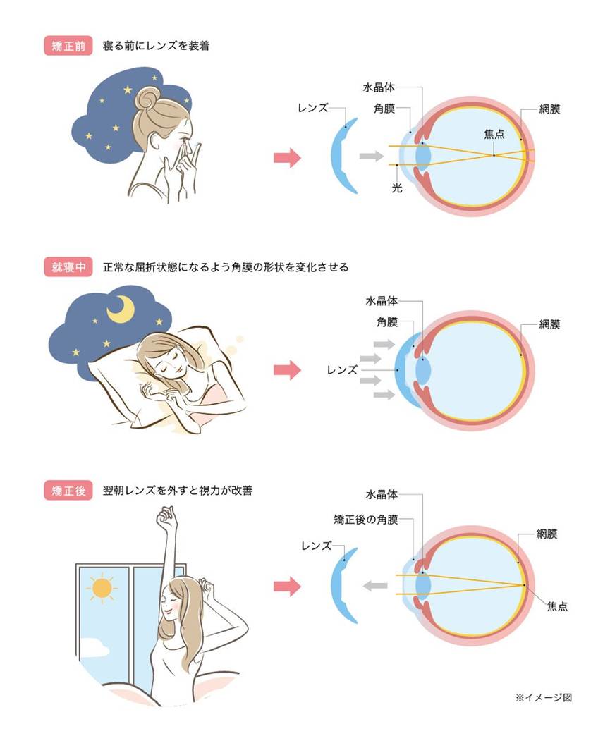 ߎ̌m肽I ͉񕜂͂łH CɂȂߎ̃JjY ...